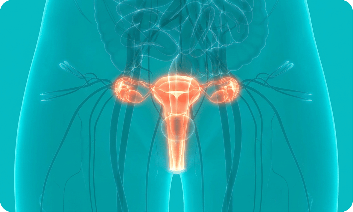 tratamiento-para-cancer-cervicouterino-infografia